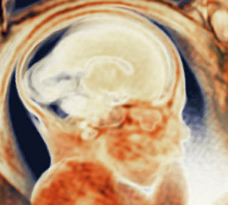 MRI scan of human fetus at 35 weeks and 1 day
