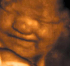 ultrasound of human fetus 36 weeks and 1 day