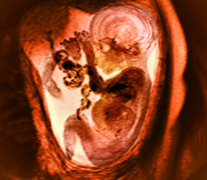 ultrasound of breech baby at 37 weeks exactly