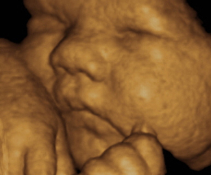 ultrasound of human fetus 38 weeks and 2 days