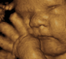 ultrasound of human fetus 38 weeks and 4 days