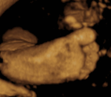 ultrasound of human fetus 38 weeks and 6 days