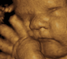 ultrasound of human fetus 39 weeks exactly