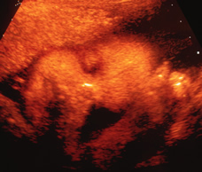 ultrasound of human fetus 39 weeks and 6 days