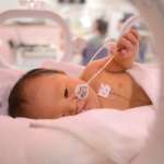 Baby Boy With Down Syndrome in NICU 