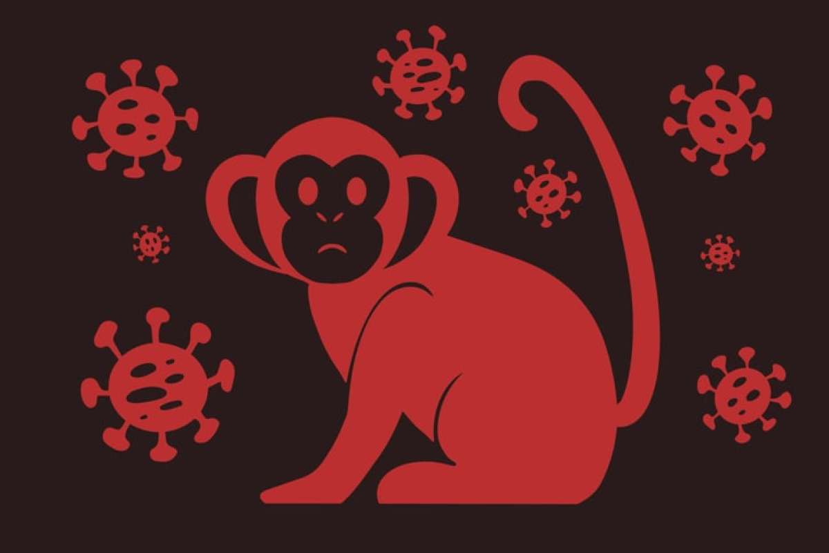 Monkeypox outbreak