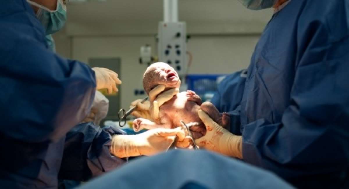 Risks and Types of C-Sections