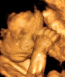 Fetus 25 Weeks 3 Days