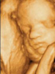 Fetus 35 Weeks 4 Days