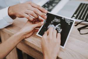 11 week fetus ultrasound photo 