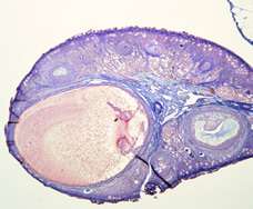 mature ovarian follicle on day 12 of menstrual cycle