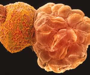 blastocyst hatching from its shell