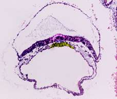 human embryo developing its third layer