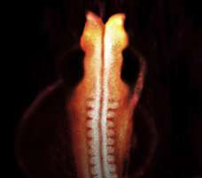 human embryo at 5 weeks and 1 day