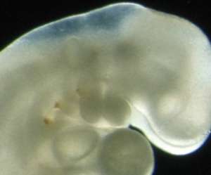 human embryo at 5 weeks and 2 days