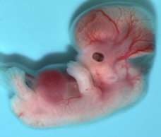 human embryo at 7 weeks and 1 day