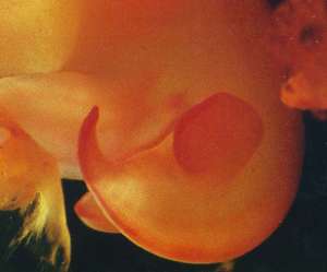 ultrasound of human embryo at 7 weeks and 3 days
