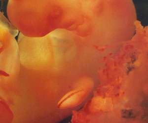 ultrasound of human embryo at 7 weeks and 4 days