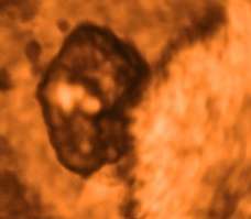 ultrasound of human embryo at 7 weeks and 5 days