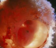 ultrasound of human embryo at 8 weeks and 1 day
