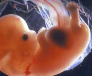 human fetus at 9 weeks and 1 day