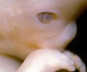 human fetus at 9 weeks and 2 days