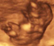 ultrasound of human fetus at 9 weeks and 6 days