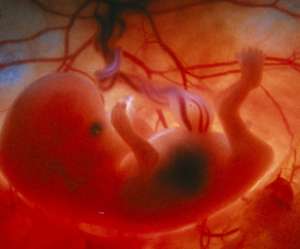 human fetus and umbilical cord at 10 weeks and 4 days