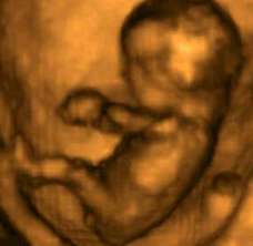 ultrasound of human fetus at 12 weeks and 1 day