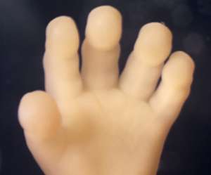 hand of human fetus at 15 weeks and 2 days