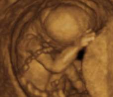 ultrasound of human fetus at 16 weeks and 3 days