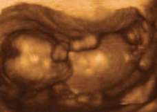 ultrasound of human fetus at 16 weeks and 5 days
