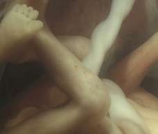 ultrasound of human fetus at 17 weeks and 2 days