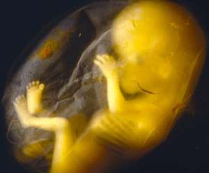 human fetus in amniotic sac at 19 weeks and 1 day