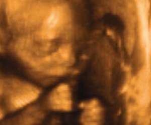 ultrasound of human fetus at 19 weeks and 4 days