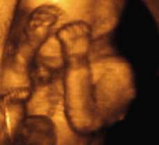 ultrasound of human fetus at 19 weeks and 6 days