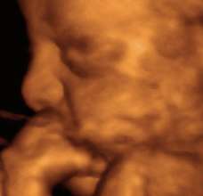 ultrasound of human fetus at 21 weeks and 3 days