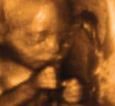 ultrasound of human fetus at 23 weeks and 1 day