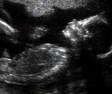 ultrasound of human fetus at 24 weeks exactly
