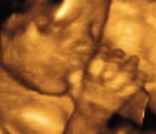 ultrasound of human fetus at 24 weeks and 4 days