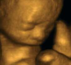 ultrasound of human fetus at 25 weeks exactly