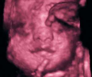 ultrasound of human fetus at 25 weeks and 6 days