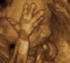 ultrasound of human fetus as 26 weeks and 4 days