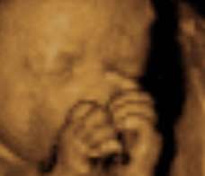 ultrasound of human fetus as 26 weeks and 6 days