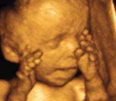 ultrasound of human fetus as 27 weeks and 2 days