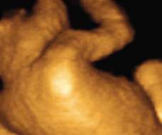ultrasound of human fetus as 27 weeks and 4 days