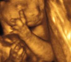 ultrasound of human fetus as 27 weeks and 5 days