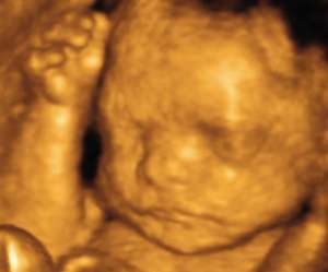 ultrasound of human fetus as 28 weeks and 2 days