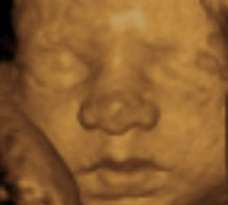ultrasound of human fetus 29 weeks and 5 days