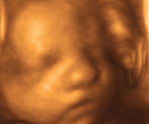 ultrasound of human fetus 30 weeks and 2 days